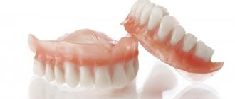 К чему снятся зубные протезы