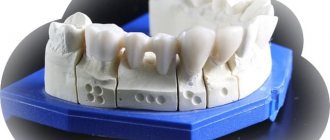 Dream interpretation tooth chipped