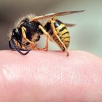 Укус пчелы за палец